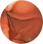 정상위 이미지 1