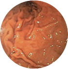 정상위 이미지 2