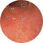 조기위암 이미지 2